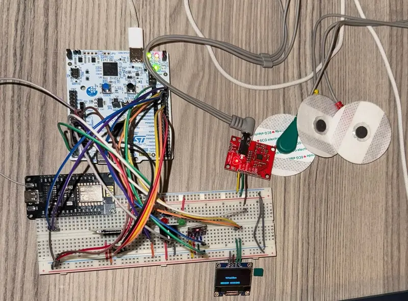 VitalBox hardware prototype 1