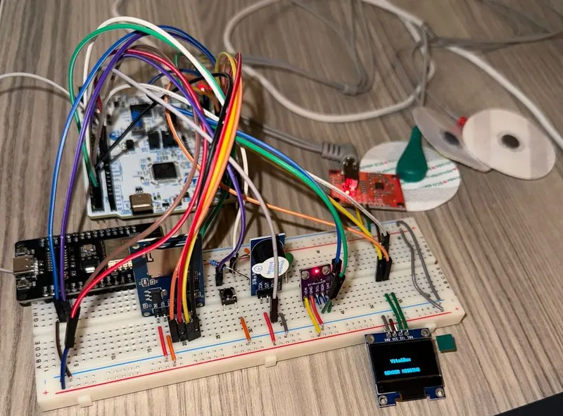 VitalBox hardware prototype 2